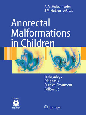 cover image of Anorectal Malformations in Children